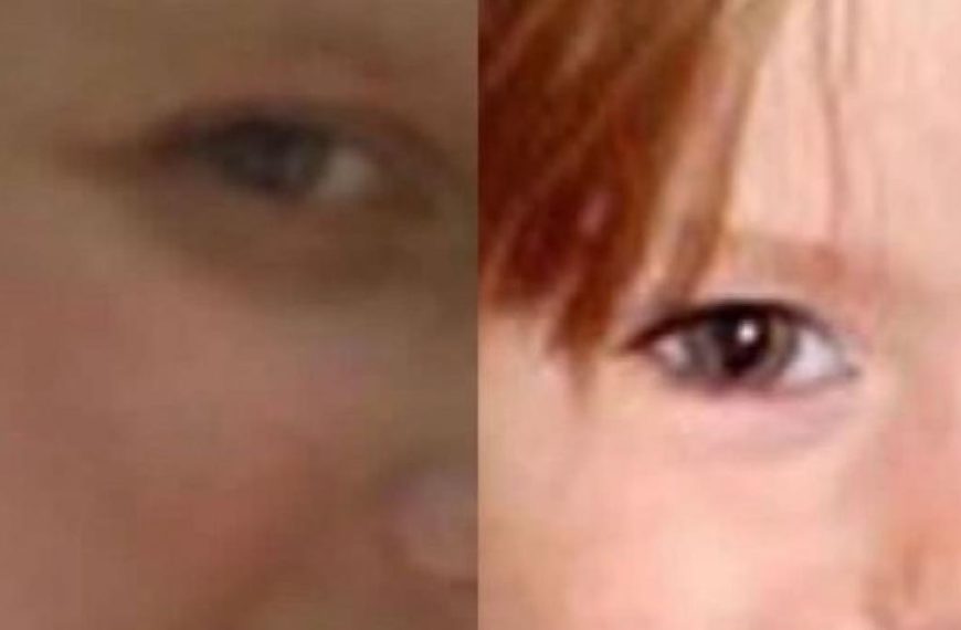 Qué es la mancha en el ojo que comparte Madeleine McCann con Julia, la joven polaca que dice ser ella