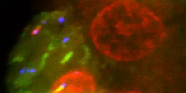 las-celulas-del-cancer-envejecen-al-sistema-inmune-para-formar-tumores