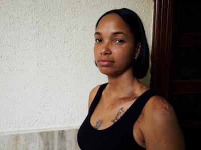 yoselin-sanchez,-victima-de-intento-de-feminicidio-pide-justicia